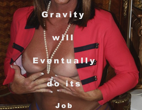 Transgender Breast Augmentation Tip 3